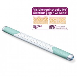 Антицеллюлитный массажер Beurer Cellulite ReleaZer Антицеллюлитный массажер Beurer Cellulite ReleaZer